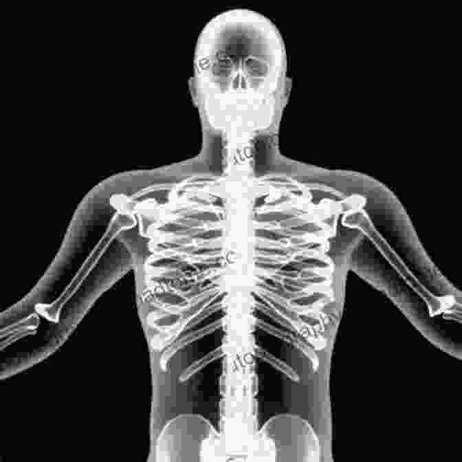 An X Ray Image Of A Human Skeleton Medical Marvels: The 100 Greatest Advances In Medicine