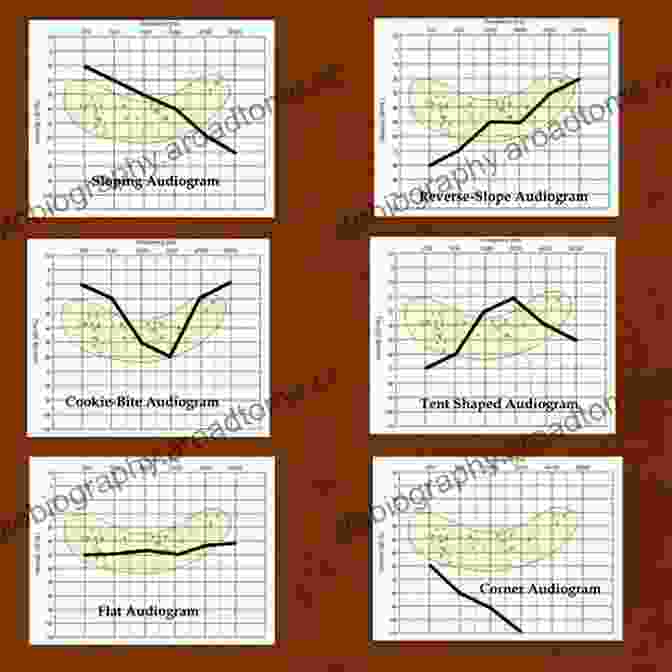 Audiogram Depicting Different Types Of Hearing Loss The SAGE Deaf Studies Encyclopedia