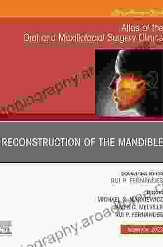 Contemporary Rhytidectomy An Issue Of Atlas Of The Oral Maxillofacial Surgery Clinics (Clinics Review Articles: Oral Maxillofacial Surgery 22)