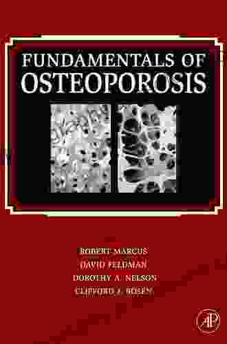 Fundamentals Of Osteoporosis C Pinedo