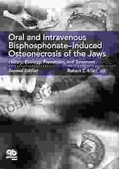 Oral And Intravenous Bisphosphonate Induced Osteonecrosis Of The Jaws: History Etiology Prevention And Treatment Second Edition