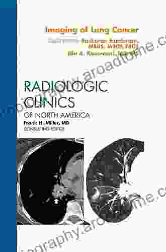 Imaging Of Lung Cancer An Issue Of Radiologic Clinics Of North America (The Clinics: Radiology 50)