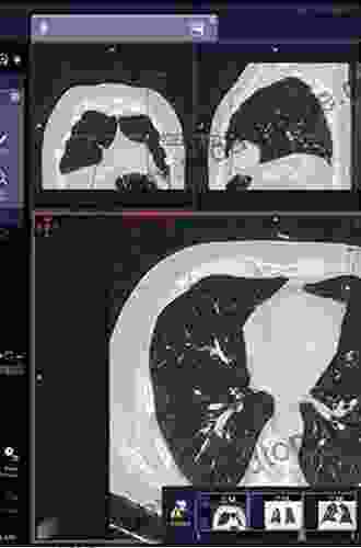 Lung Imaging And Computer Aided Diagnosis