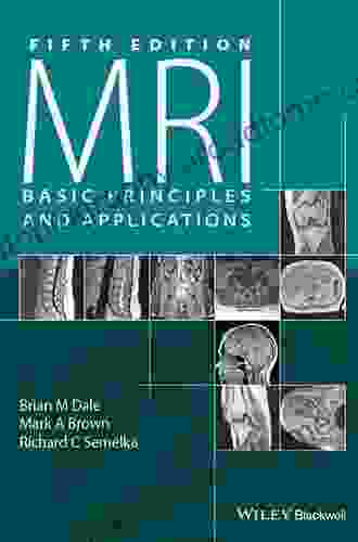 Nanomagnetic Actuation In Biomedicine: Basic Principles And Applications