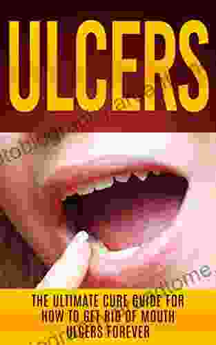 Ulcers: The Ultimate Cure Guide For How To Get Rid Of Mouth Ulcers Instantly (Ulcer Free Ulcer Diet Mouth Ulcer Cure Oral Ulcer)