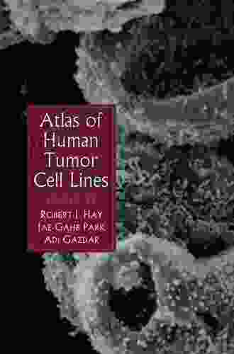 Atlas of Human Tumor Cell Lines