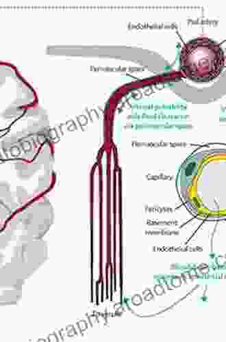 Cerebral Small Vessel Disease